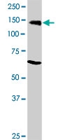 MAB0003 - Retinoblastoma-associated protein / RB1