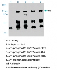 MAB0003 - Retinoblastoma-associated protein / RB1
