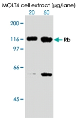 MAB0003 - Retinoblastoma-associated protein / RB1