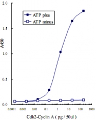 MAB0004 - Retinoblastoma-associated protein / RB1