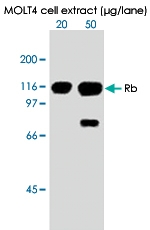 MAB0004 - Retinoblastoma-associated protein / RB1