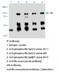 MAB0005 - Retinoblastoma-associated protein / RB1
