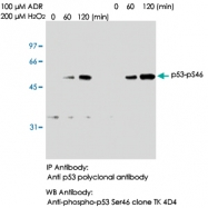 MAB0011 - TP53 / p53