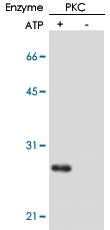 MAB0013 - PPP1R14A