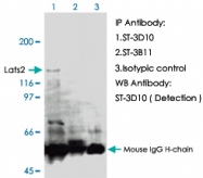 MAB0019 - LATS2