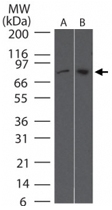 MAB0053 - TBK1