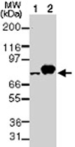 MAB0053 - TBK1