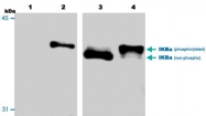 MAB0057 - NFKBIA / IKBA