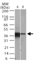 MAB0057 - NFKBIA / IKBA