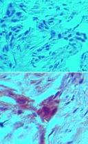 MAB0059 - ARHGDIB / D4-GDI