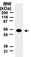 MAB0062 - TRAF5 / RNF84