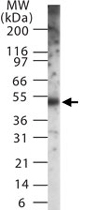 MAB0063 - RAD9A