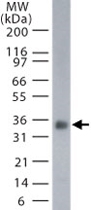 MAB0064 - CD254 / RANKL