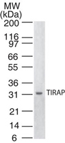 MAB0073 - TIRAP