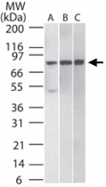 MAB0075 - IKBKB / IKKB