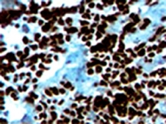 MAB0076 - Myogenin