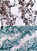 MAB0077 - MYOD1