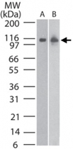MAB0078 - DNMT3B