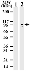 MAB0078 - DNMT3B
