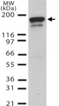 MAB0079 - DNMT1