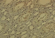 MAB0079 - DNMT1