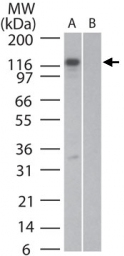 MAB0080 - DNMT3A