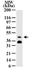MAB0083 - FOSB