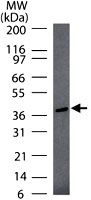 MAB0084 - TINF2 / TIN2
