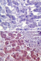 MAB0086 - CD286 / TLR6