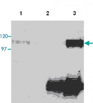 MAB0091 - CD265 / RANK