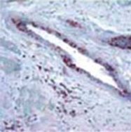 MAB0096 - Retinoblastoma-associated protein / RB1