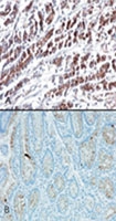 MAB0099 - HTRA2 / PRSS25