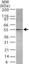 MAB0101 - Presenilin-2