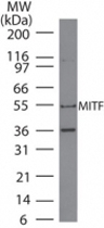 MAB0103 - MITF