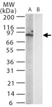MAB0104 - TLR12