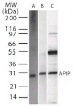 MAB0105 - APIP