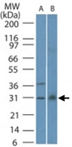 MAB0106 - Bax inhibitor 1