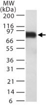 MAB0108 - Anthrax toxin receptor 1 / ANTXR1