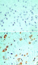 MAB0109 - TLR5