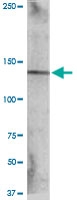 MAB0115 - HGF receptor