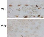 MAB0118 - Estrogen receptor alpha