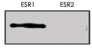 MAB0118 - Estrogen receptor alpha