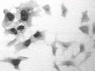 MAB0119 - Glucocorticoid receptor