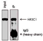 MAB0119 - Glucocorticoid receptor