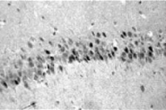 MAB0119 - Glucocorticoid receptor