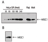MAB0119 - Glucocorticoid receptor