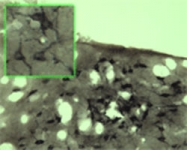 MAB0291 - CD271 / NGFR