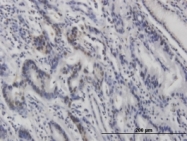 MAB0659 - TP53 / p53