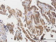 MAB0659 - TP53 / p53