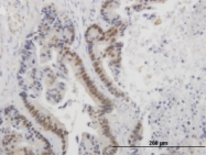 MAB0659 - TP53 / p53